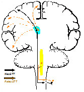 Contralateral loss