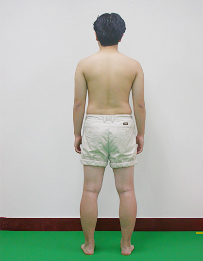 바로 선 자세 후면 평가